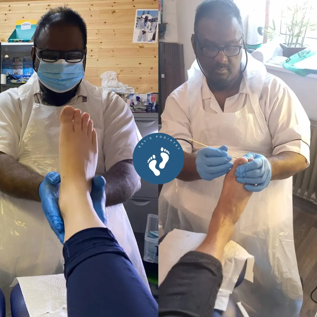 Ray treating patients' feet, wearing a mask and gloves